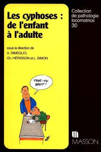 Les cyphoses : de l'enfant à l'adulte