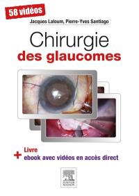 Chirurgie des glaucomes