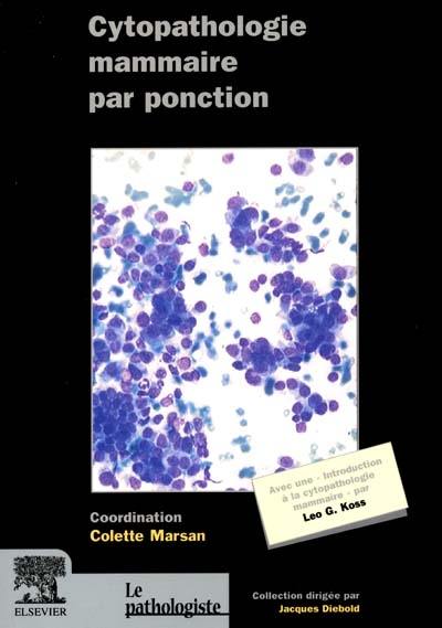 Cytopathologie mammaire par ponction