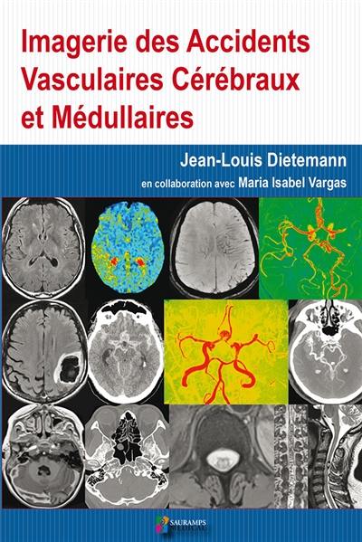 Imagerie des accidents vasculaires cérébraux et médullaires