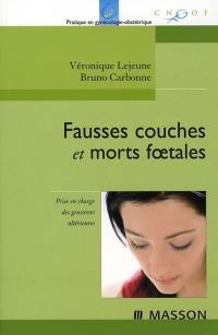 Fausses couches et morts foetales : prise en charge immédiate et à long terme