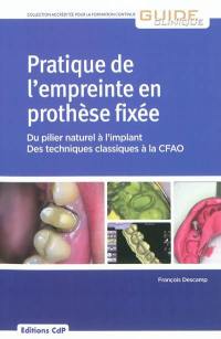 Pratique de l'empreinte en prothèse fixée : du pilier naturel à l'implant : des techniques classiques à la CFAO