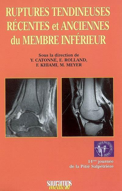 Ruptures tendineuses récentes et anciennes du membre inférieur