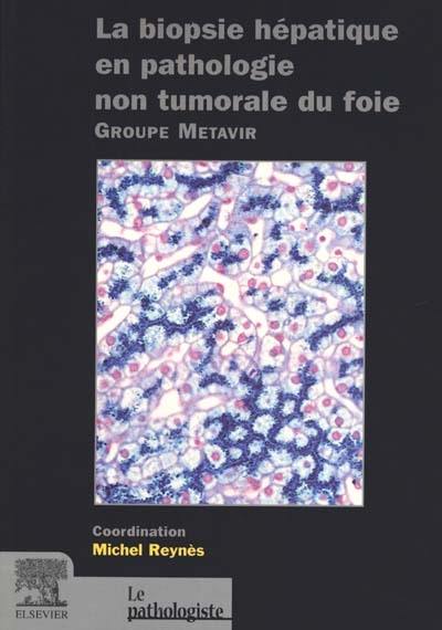 La biopsie hépatique en pathologie non tumorale du foie