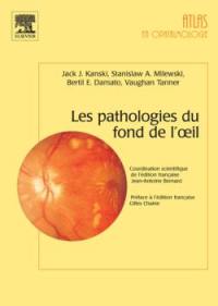 Les pathologies du fond de l'oeil