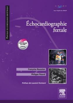 Echocardiographie foetale