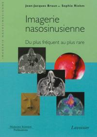 Imagerie nasosinusienne : du plus fréquent au plus rare