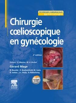 Chirurgie coelioscopique en gynécologie