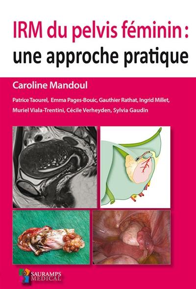 IRM du pelvis féminin : une approche pratique IRM du pelvis féminin : une approche pratique