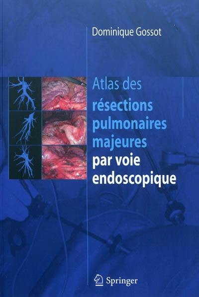 Atlas des résections pulmonaires majeures par voie endoscopique