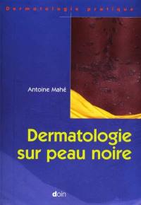 Dermatologie sur peau noire