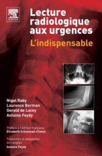 Lecture radiologique aux urgences : l'indispensable