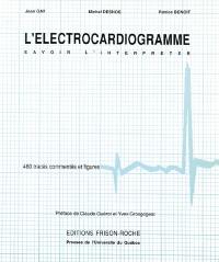 L'électrocardiogramme