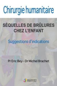 Chirurgie humanitaire : séquelles de brûlures chez l'enfant, suggestions d'indications : 20 ans d'expérience en Asie du Sud-Est aux côtés de la fondation Children Action. Humanitarian surgery, burn sequelae in children : suggestions for indications : a twenty-year experience in South-East Asia alongside Children Action foundation