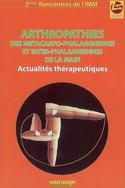 Arthropathies des métacarpo-phalangiennes et inter-phalangiennes de la main : actualités thérapeutiques