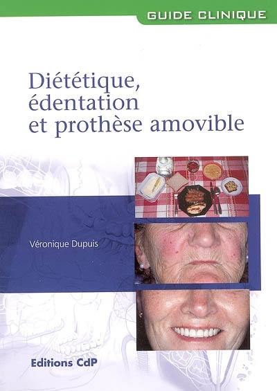 Diététique, édentation et prothèse amovible