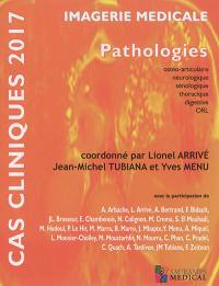 Imagerie médicale : pathologies ostéo-articulaire, neurologique, sénologique, thoracique, digestive, ORL