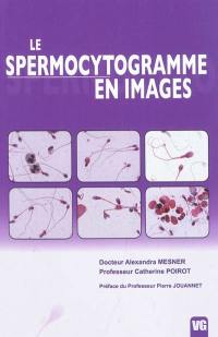 Le spermocytogramme en images