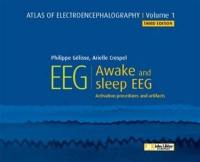 Atlas of electroencephalography. Vol. 1. Awake and sleep EEG : activation procedures and artifacts