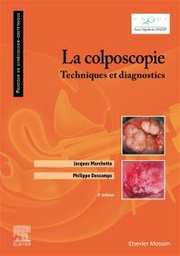 La colposcopie : techniques et diagnostics