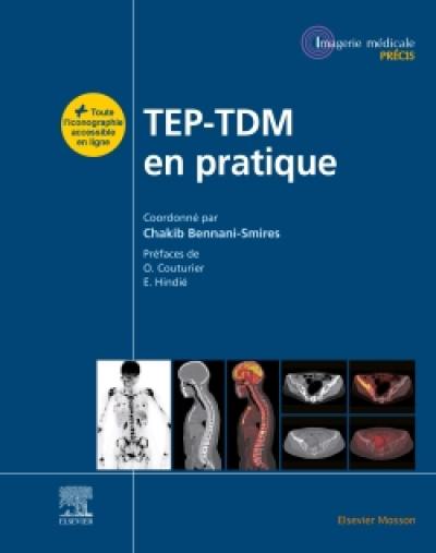 TEP-TDM en pratique