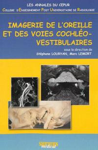 Imagerie de l'oreille et des voies cochléo-vestibulaires