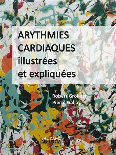 Arythmies cardiaques illustrées et expliquées