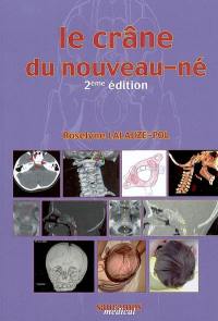 Le crâne du nouveau-né : des contraintes foetales et leurs enjeux neurologiques aux répercussions chez l'adulte