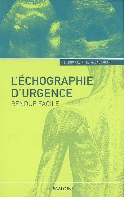 L'échographie d'urgence rendue facile