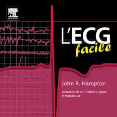 L'ECG facile