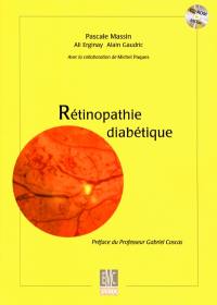 Rétinopathie diabétique