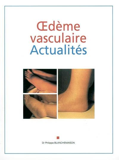 Oedème vasculaire : actualités