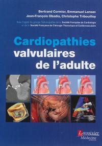 Cardiopathies valvulaires de l'adulte