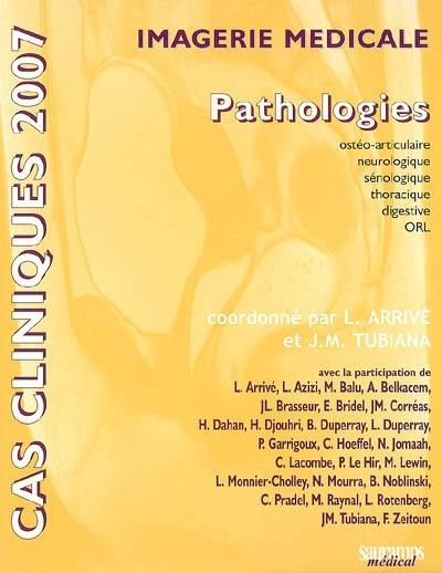 Imagerie médicale : pathologies ostéo-articulaire, neurologique, sénologique, thoracique, digestive, ORL