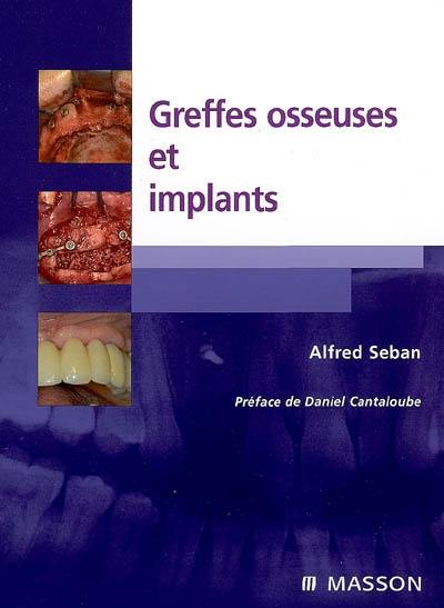 Greffes osseuses et implants