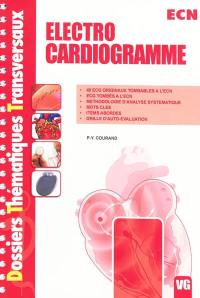 Electrocardiogramme : ECN