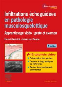 Infiltrations échoguidées en pathologie musculosquelettique : apprentissage vidéo : geste et examen