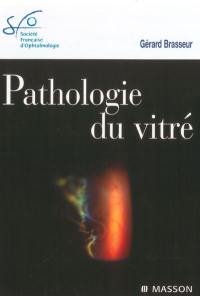 Pathologie du vitré